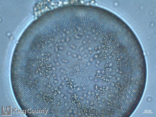 Photo of Coscinodiscus spp.